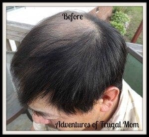 AFM viviscal before