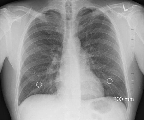 healthy lung month