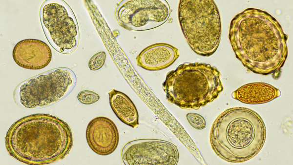 How To Recognize If You Have Parasites