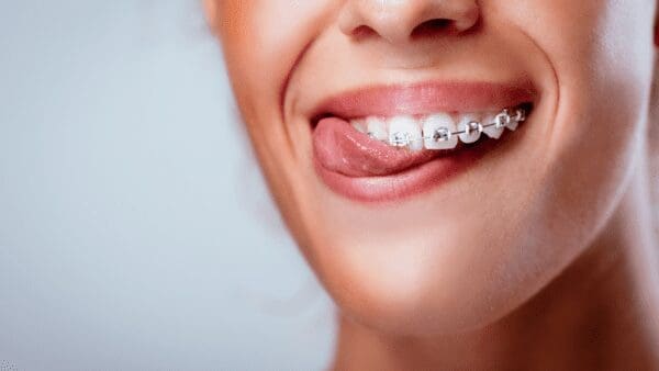 Benefits of Seeing an Orthodontist from North Carolina Lifestyle Blogger Adventures of Frugal Mom