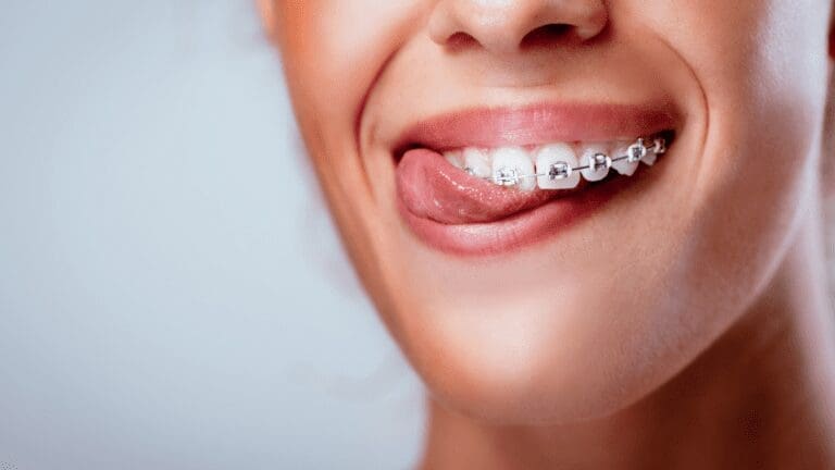 Benefits of Seeing an Orthodontist from North Carolina Lifestyle Blogger Adventures of Frugal Mom