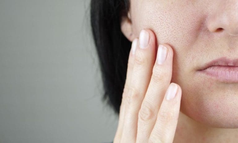 The Most Common Causes of Oily Skin