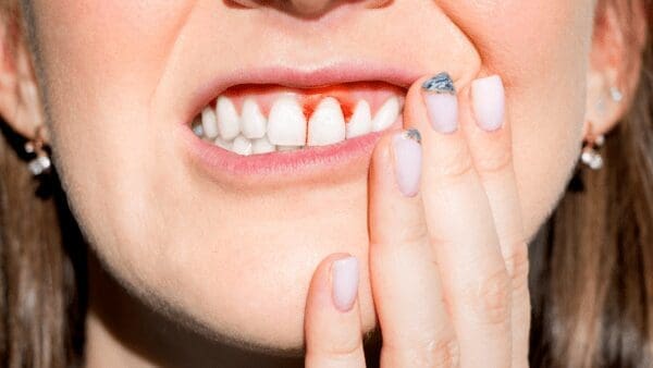How Laser Periodontal Therapy Treats Gum Disease from North Carolina Lifestyle Blogger Adventures of Frugal Mom