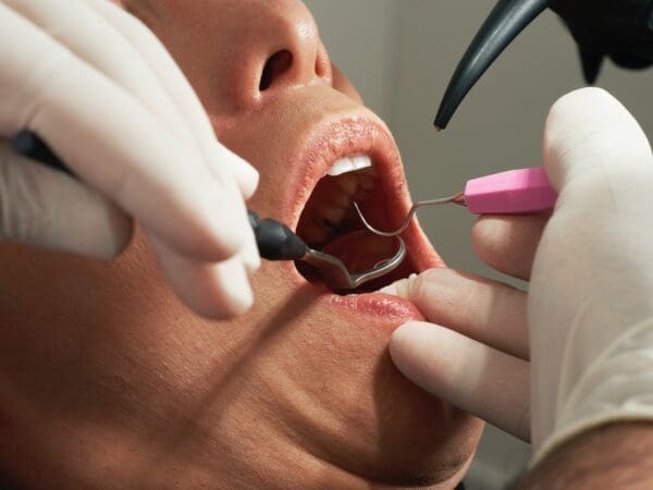  3 Most Sought-After Dental Services in Mission Viejo, California