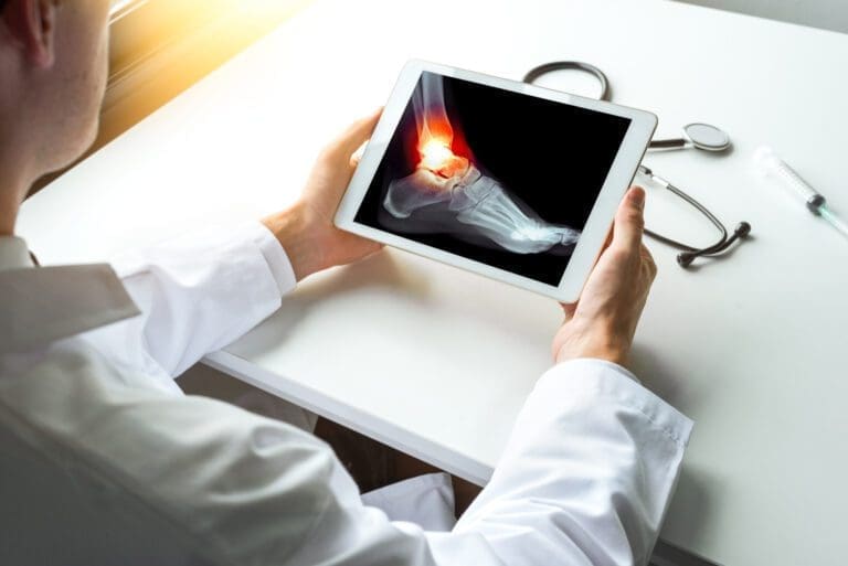 What To Expect In An Ankle Surgery And Reconstruction Procedure 