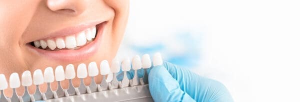 Maximizing Your Teeth Whitening Results: 8 Dos And Don'ts