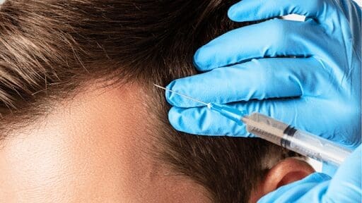 PRP Injections- Unlocking the Healing Potential