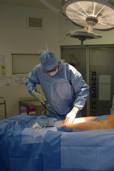 How Long Does It Take to Recover from Liposuction Surgery and What Should You Expect?
