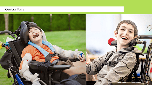 The Types of Cerebral Palsy and Their Causes