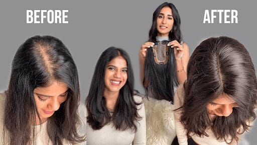 Hair Patch- A Partial Hair Loss Solution for Women