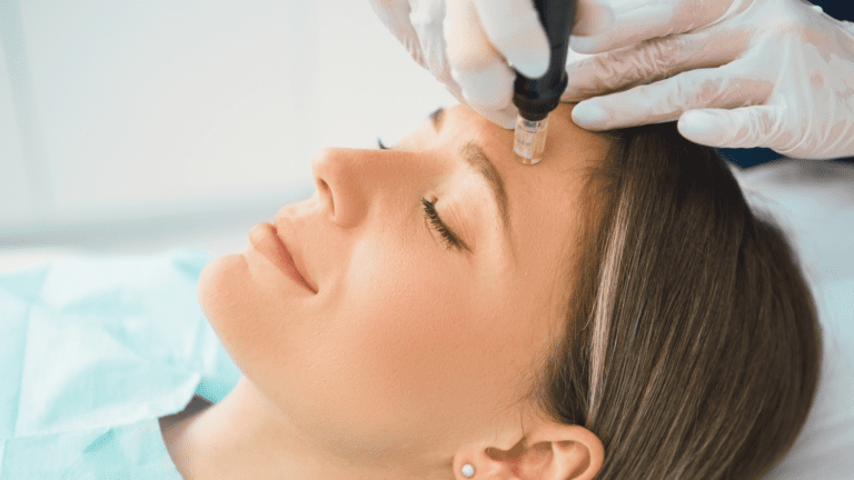 How RF Needling Can Revolutionize Your Skincare Routine
