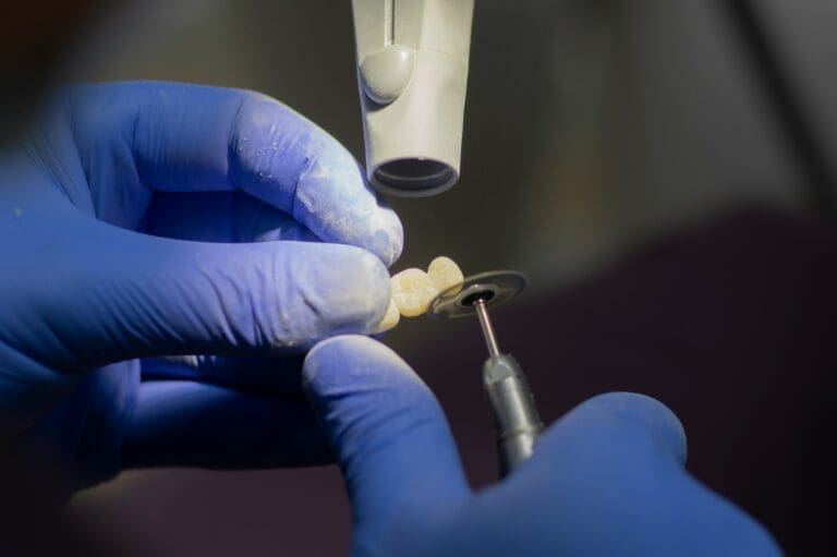 Dental Implants: Modern Solutions for Lasting Smiles