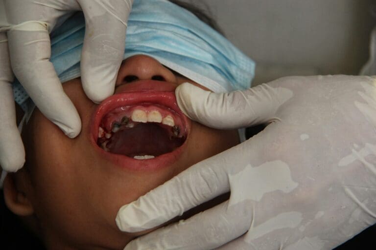 Everything You Need to Know Before Getting Dental Implants for Yourself or Child