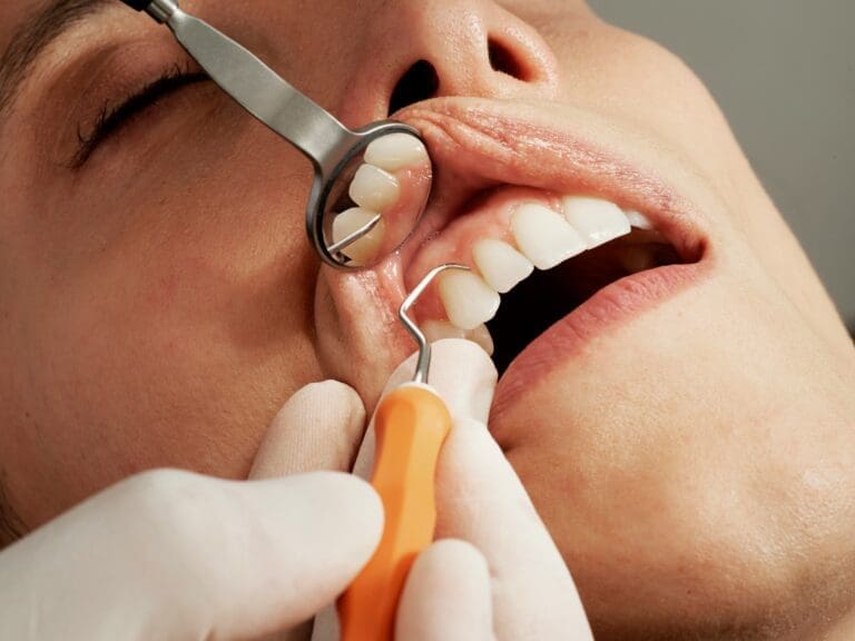 A Consumer’s Guide to Modern Tooth Replacement Options