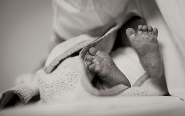 The Lifelong Impact of Preventable Birth Injuries