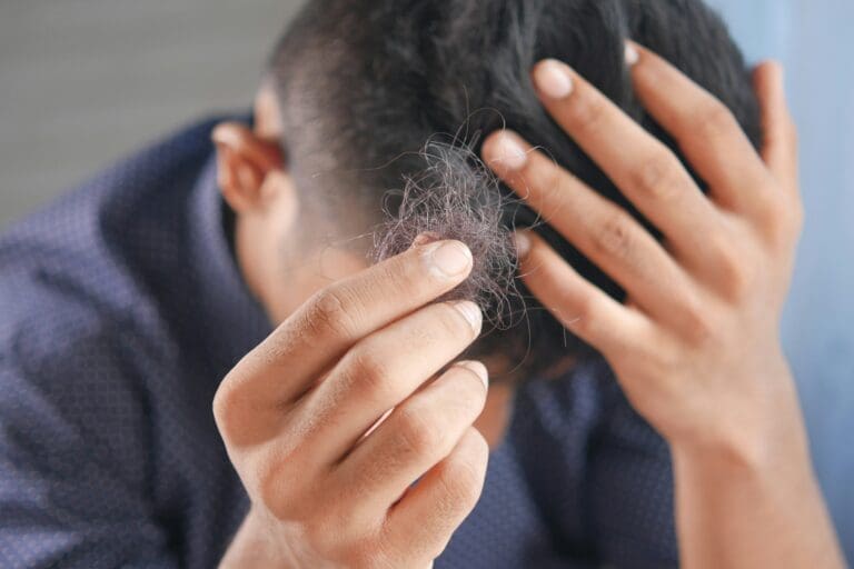 How Dermatologists Identify and Treat Stress-Related Hair Loss