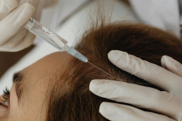 PRP Injections for Hair Loss: How the Treatment Works and What to Expect