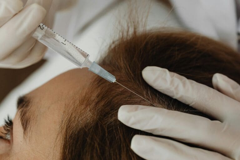 PRP Injections for Hair Loss: How the Treatment Works and What to Expect