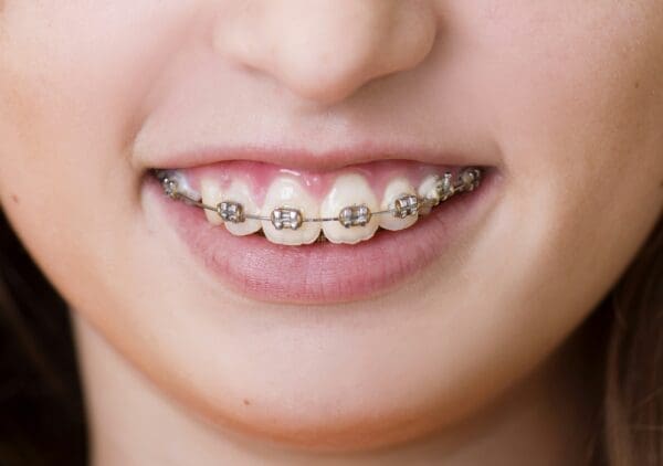 Why Orthodontics Is A Long Term Investment In Health

