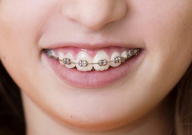 Why Orthodontics Is A Long Term Investment In Health