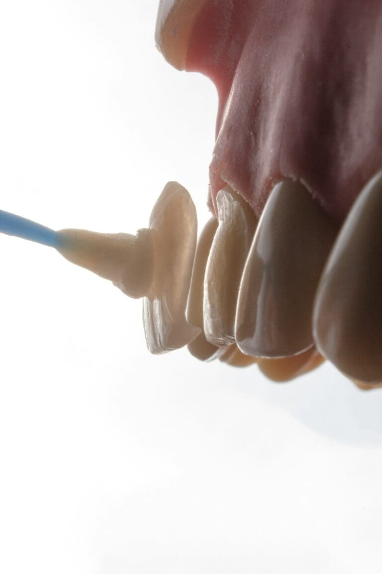 The Role Of Bioceramics In Durable Restorative Dentistry