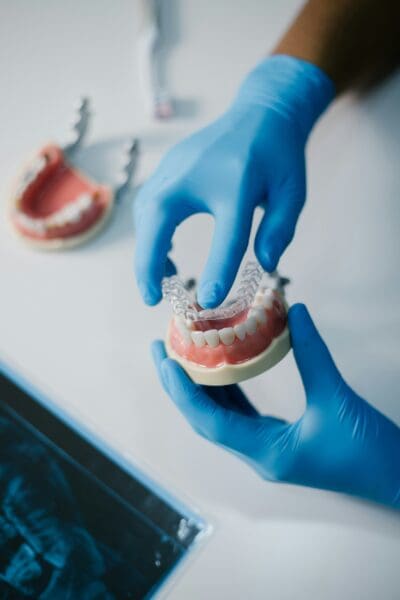 How Clear Aligners Are Used In Pre Restorative Dental Planning