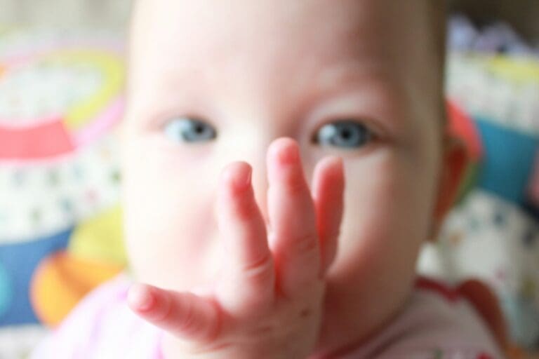 Thumb Sucking And Open Bite: How Dentists And Orthodontists Team Up