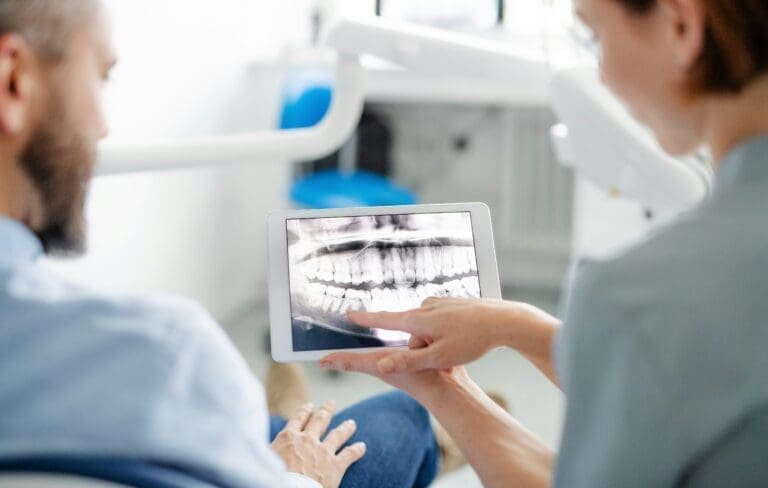 5 Benefits of Digital X-rays in General Dentistry Practices