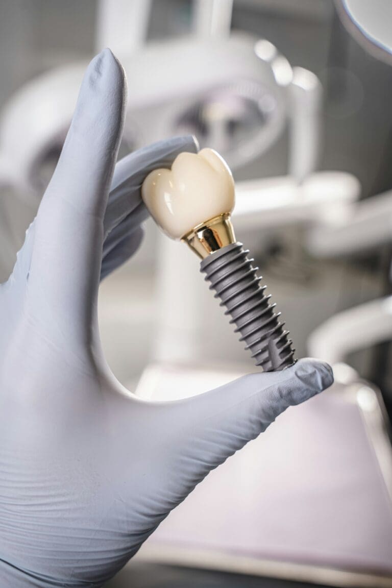 Dental Implants in Minneapolis, MN: Your Most Common Questions Answered